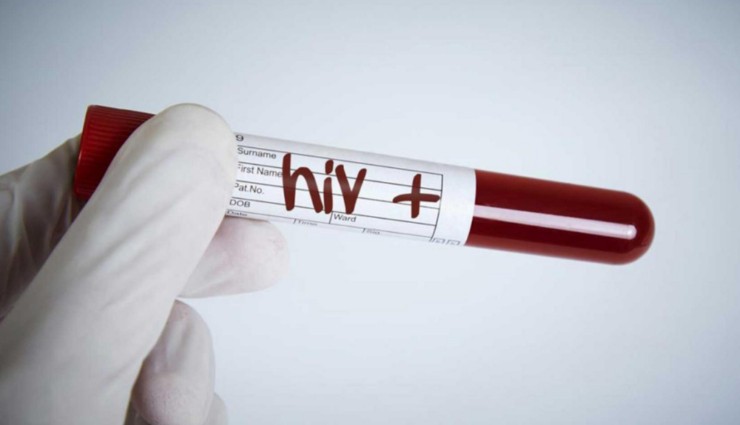 'HIV' Ebeveyn Olmaya Engel Değil!