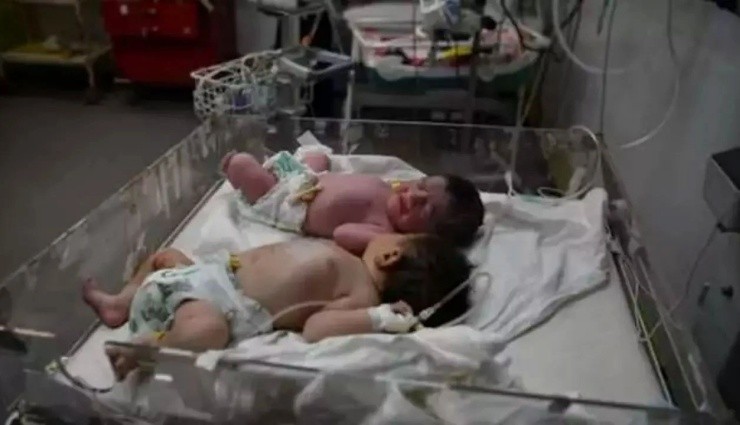 Gazze'de 2 Bebek Açlıktan Hayatını Kaybetti!