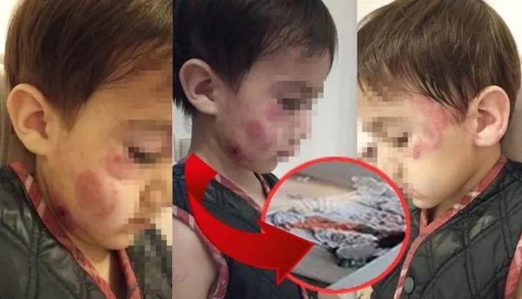 4 Yaşındaki Kız 3 Yaşındaki Erkek Çocuğuna Saldırdı!